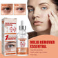 Smooth Milia Remover Serum (30ml)