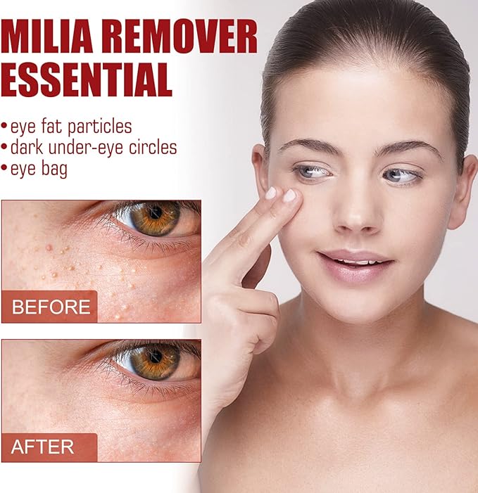 Smooth Milia Remover Serum (30ml)