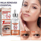 Smooth Milia Remover Serum (30ml)