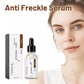 Anti Freckle Serum (30ml)